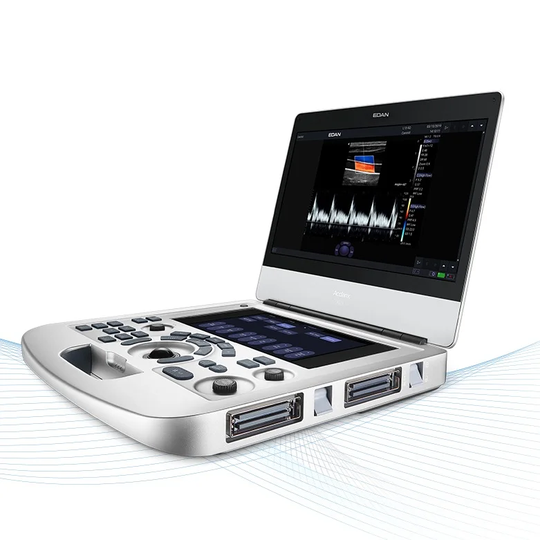 Ecógrafo EDAN Acclarix AX3 portátil — Frajmac Perú