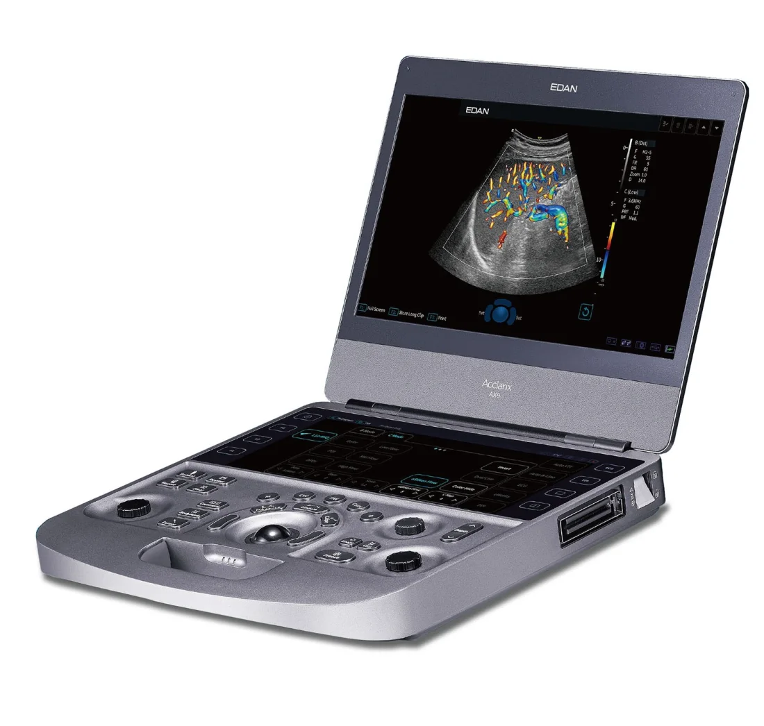Ecógrafo EDAN Acclarix AX9 con plataforma SynSight — Frajmac Perú