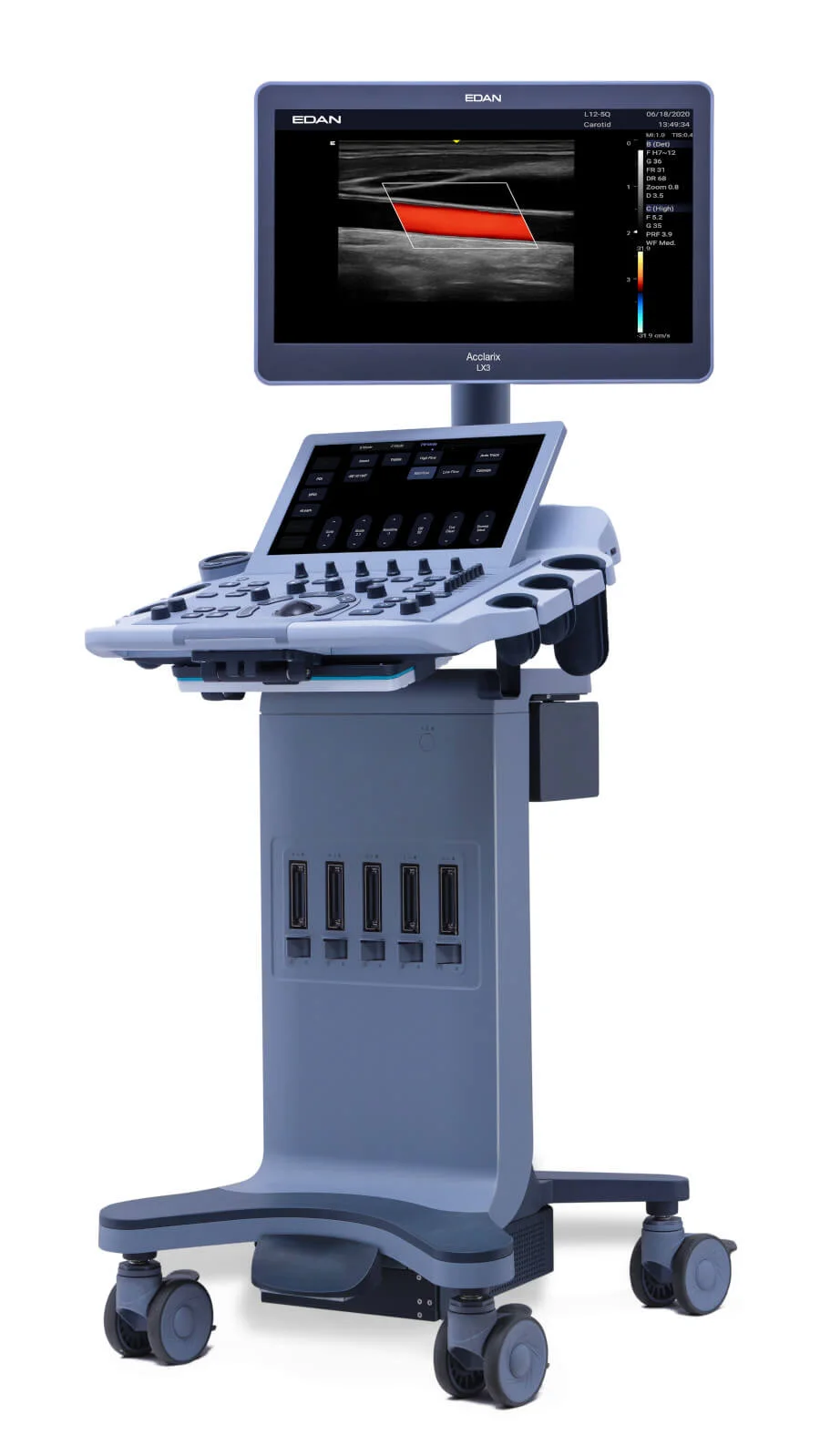 Ecógrafo EDAN Acclarix LX3 — sistema de ultrasonido de consola | Frajmac Perú