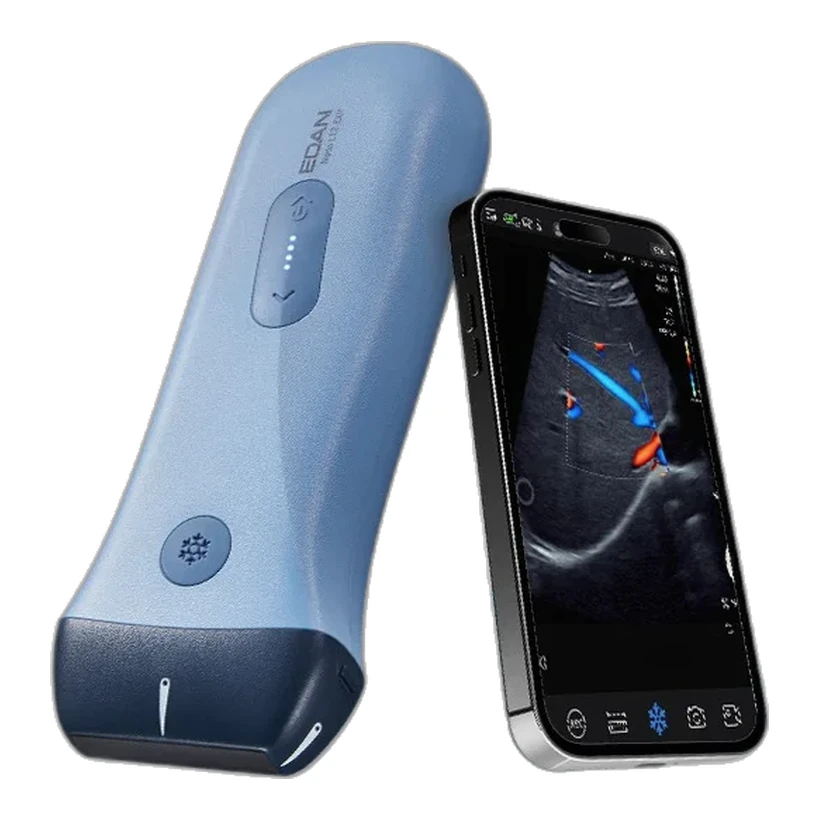 Ecógrafo de bolsillo EDAN Nano conectado a un smartphone — Frajmac Perú