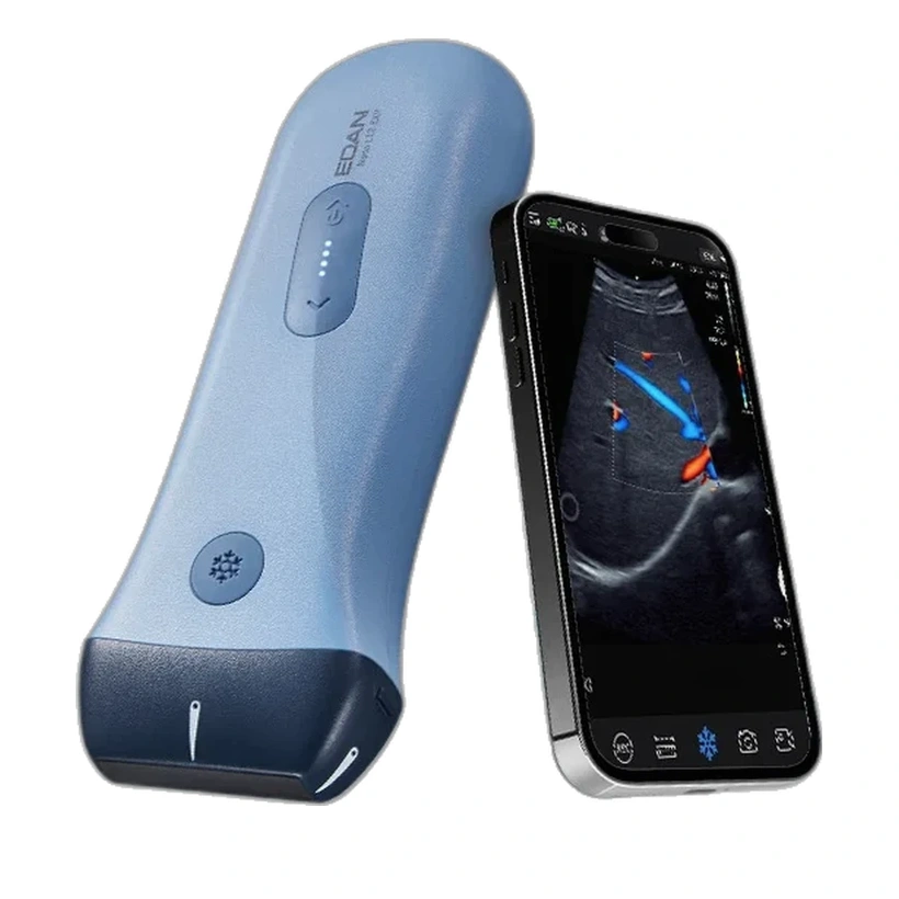 Ecógrafo de bolsillo EDAN Nano L12 EXP conectado a smartphone | Frajmac Perú